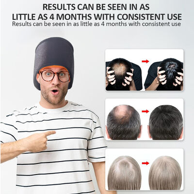 Boné para Crescimento Capilar 660nm Terapia de Luz Vermelha e Boné de Terapia de Luz Vermelha e Laser com 270 LEDs